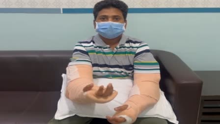 ujjain man undergoes Bilateral Hand Transplant at mumbai global hospital