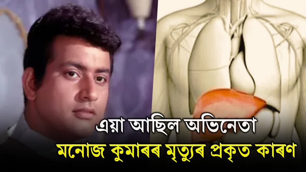 Veteran actor Manoj Kumar died due to cardiogenic shock, know its symptoms and causes