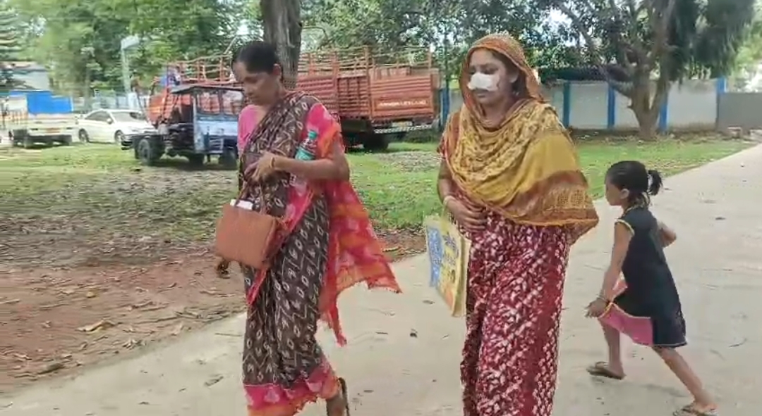 Husband bites off wife nose