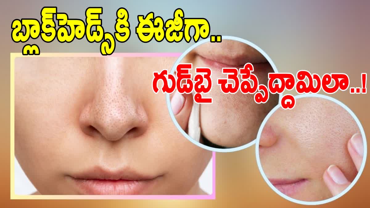 Natural Home Remedies For Blackheads