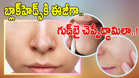 Natural Home Remedies For Blackheads