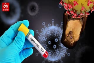 Nipah Virus test