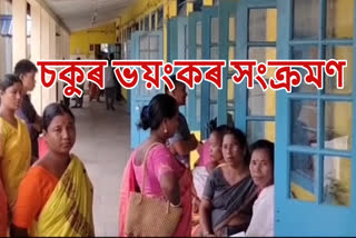 Conjunctivitis in Assam