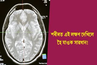 These symptoms can be caused by brain tumors