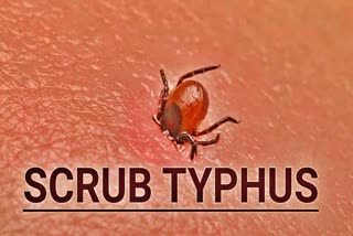 Scrub Typhus In Himachal