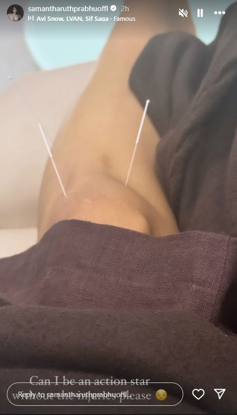 Samantha Ruth Prabhu Injures Herself During Action Scene, Shares Needle Treatment Photo