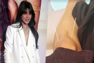 Samantha Ruth Prabhu Injures Herself During Action Scene, Shares Needle Treatment Photo