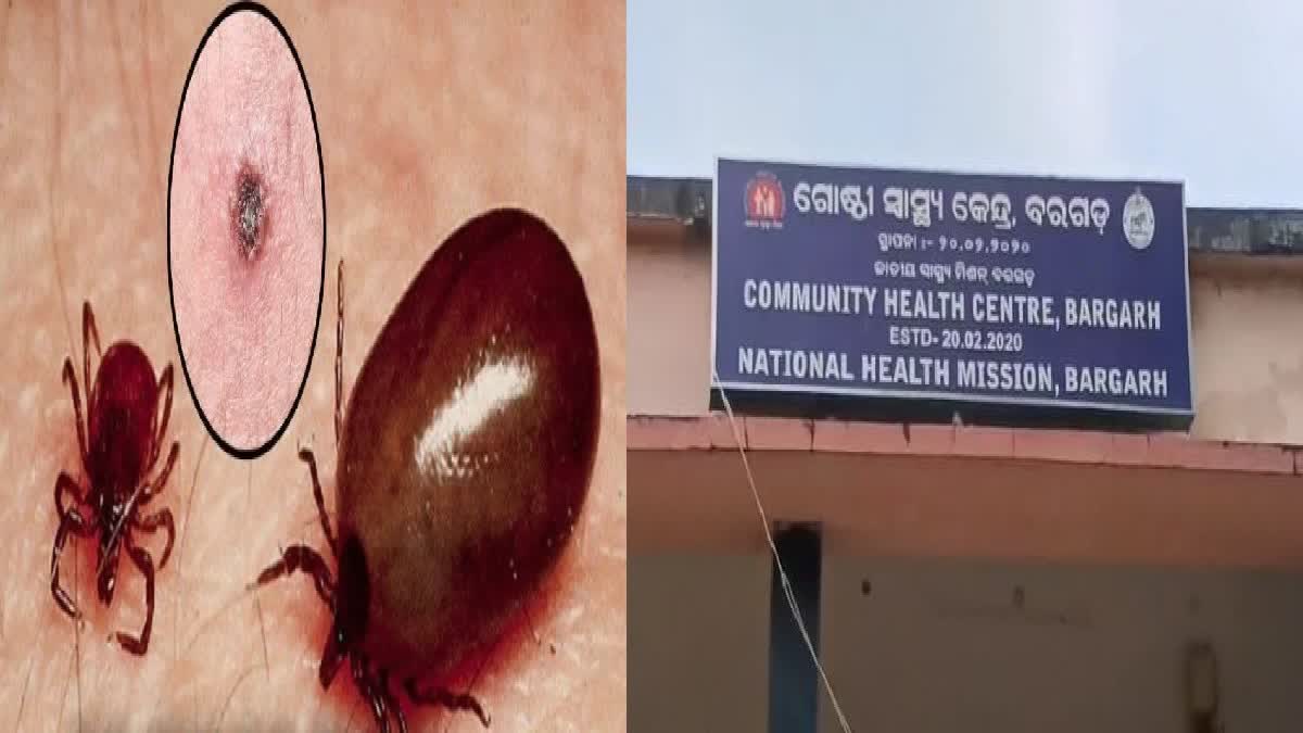 scrub typhus in bargarh