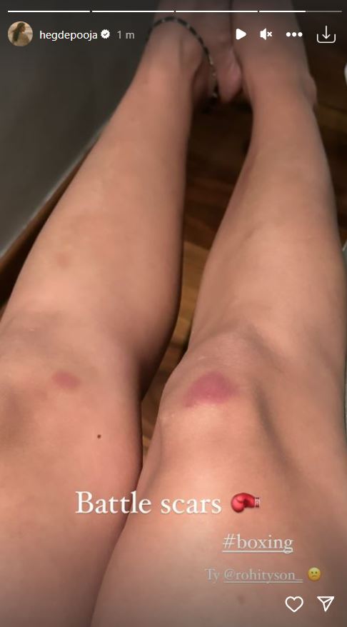 Pooja Hegde flaunts 'battle scars' as she shares aftermath of kickboxing session