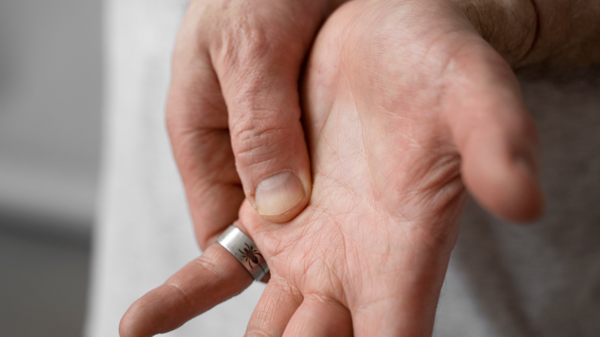 does knuckle cracking cause Arthritis?