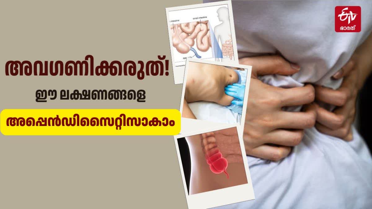 WHAT IS APPENDICITIS  APPENDICITIS TREATMENT  അപ്പെന്‍ഡിസൈറ്റിസ് ലക്ഷണം  അപ്പെന്‍ഡിസൈറ്റിസ് ചികിത്സ