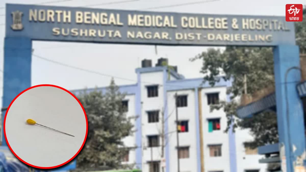 Complex Surgery in North Bengal Medical College and Hospital