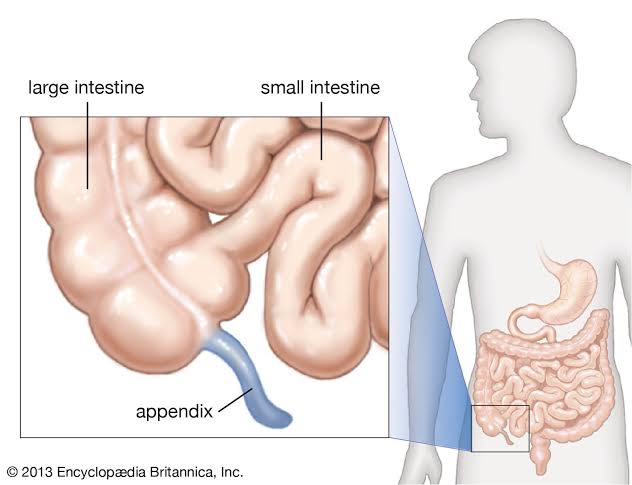 WHAT IS APPENDICITIS  APPENDICITIS TREATMENT  അപ്പെന്‍ഡിസൈറ്റിസ് ലക്ഷണം  അപ്പെന്‍ഡിസൈറ്റിസ് ചികിത്സ