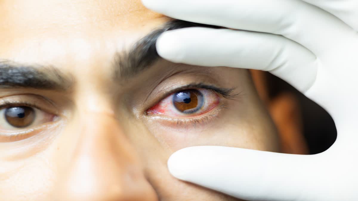 Ayurveda For Eye Care