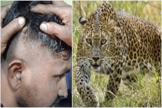 Leopard Attack On a youth who was cutting grass in Karad Taluka Satara