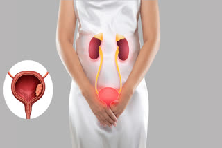 If you are suffering from this problem along with constipation, fatigue and swelling in the legs, then it could be a warning sign of bladder cancer