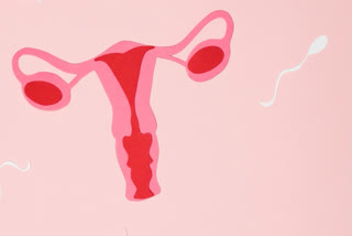 Endometriosis linked to reduction in fertility: Study