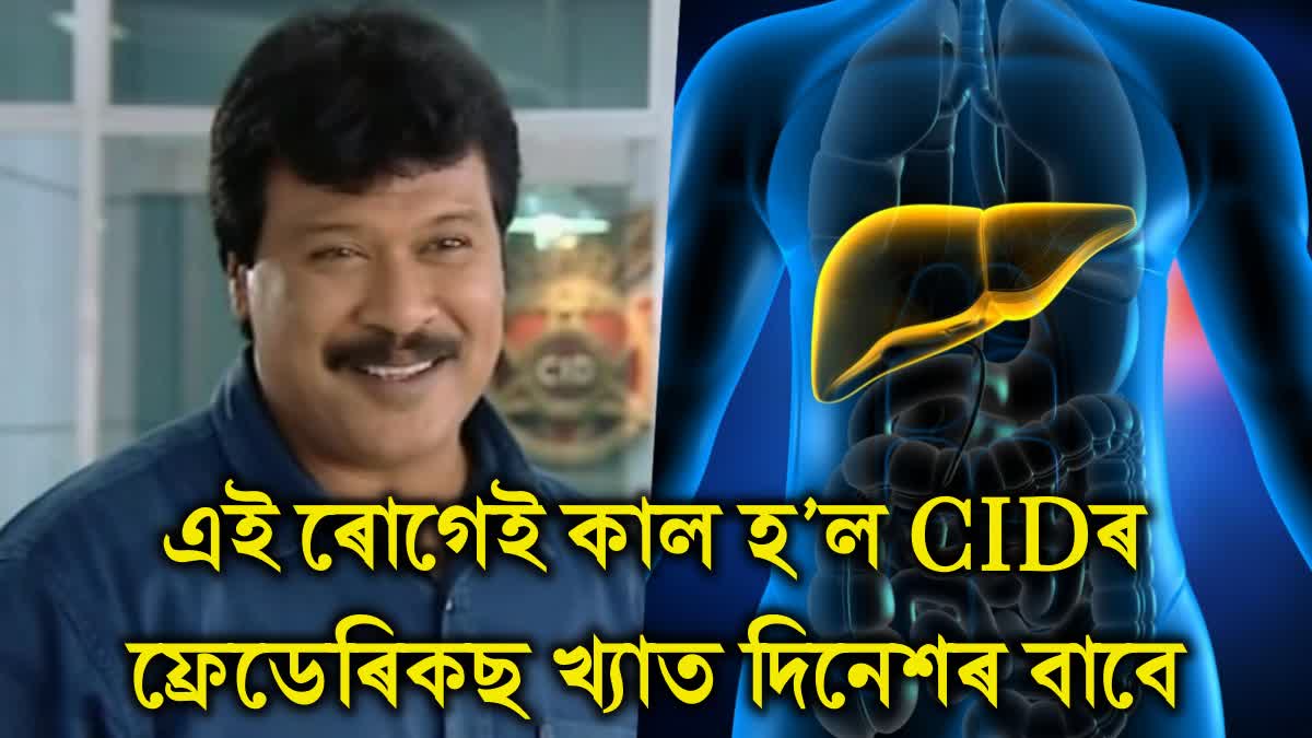 Dinesh Phadnis passed away CID actor Dinesh Phadnis was suffering from liver damage Let's know about this disease