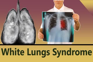 White Lungs Syndrome