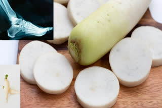 To reduce increased uric acid, eat radish daily, this vegetable is no less than a medicine