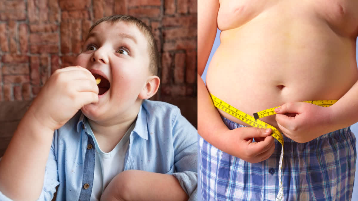 childhood obesity prevention