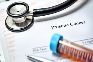 Prostate cancer screening must be done every 5-years