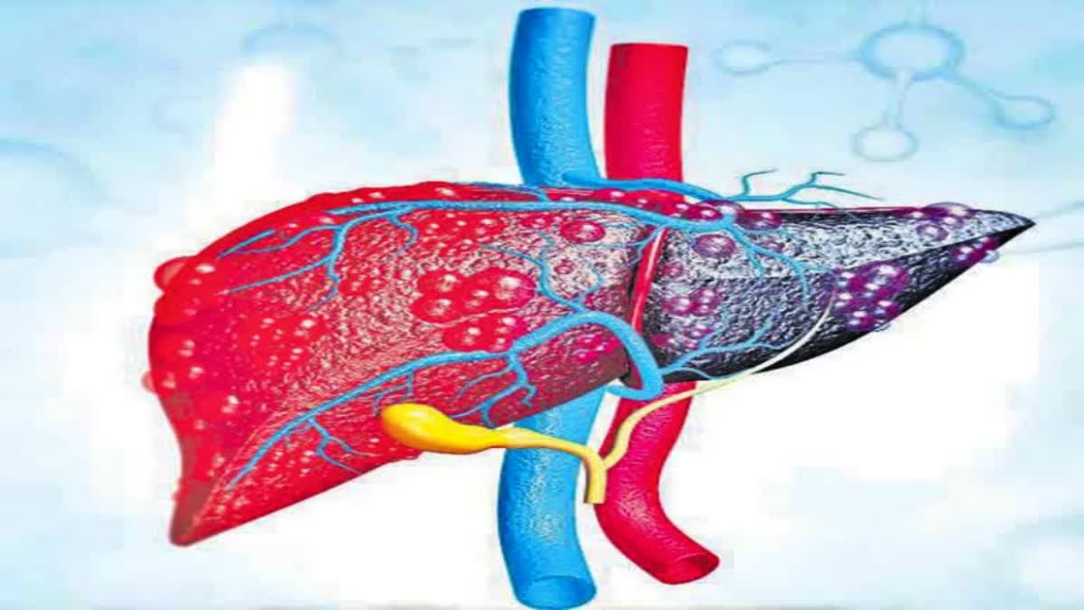 Hepatitis Cases Increasing in Konaseema District