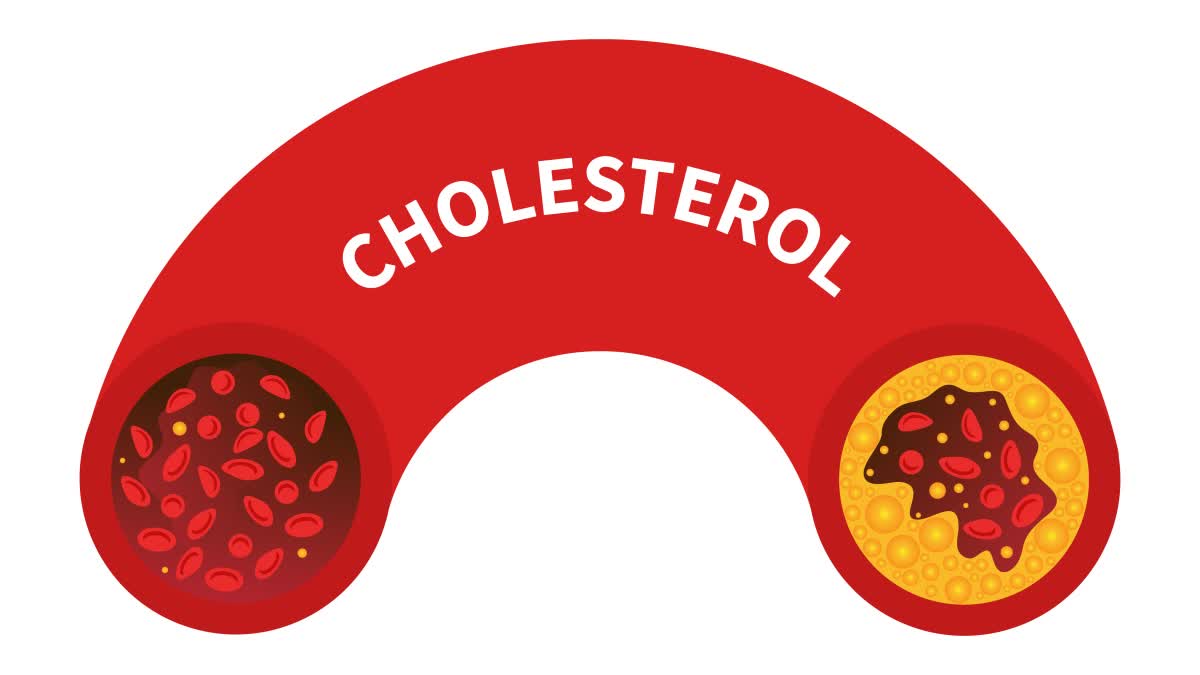 Cholesterol