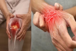 FOODS THAT REDUCE ARTHRITIS PAIN  FOODS TO EAT IF YOU HAVE ARTHRITIS  FOODS FOR ARTHRITIS AND JOINT PAIN  HOW TO GET RELIEF FROM JOIN PAIN