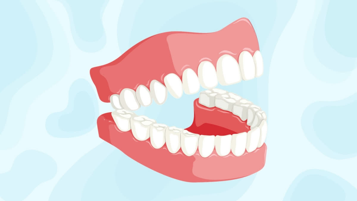 Take care of your teeth to boost brain health, ward off Alzheimer's risk