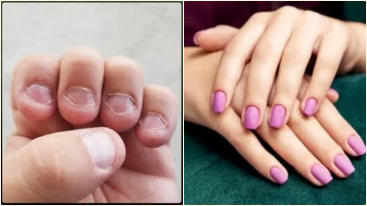 Nails Care Tips