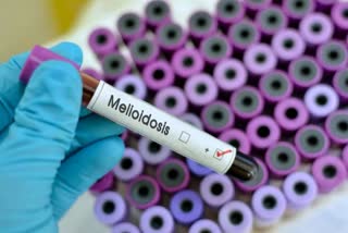 Etv Bharat Melioidosis Disease Detected In Kannur District  Melioidosis Kannur  മെലിയോയ്ഡോസിസ് രോഗബാധ  മെലിയോയ്ഡോസിസ് കണ്ണൂർ  മെലിയോയ്ഡോസിസ്