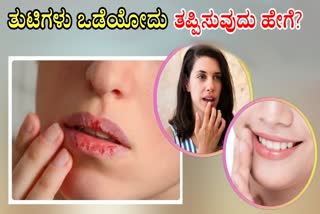 HOME REMEDIES FOR CHAPPED LIPS  NATURAL WAYS TO STOP DRY LIPS  HOW TO GET RID OF CHAPPED LIPS  WINTER LIP CARE TIPS