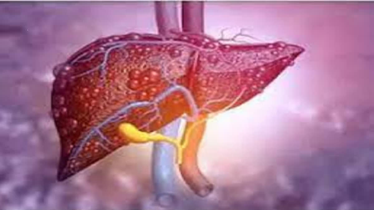 Bad breath and eye color will tell whether your liver is damage or not