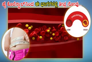 HIGH CHOLESTEROL  ಹೈ ಕೊಲೆಸ್ಟ್ರಾಲ್  PAIN IN THESE PARTS OF THE BODY  HOW TO PREVENT HIGH CHOLESTEROL