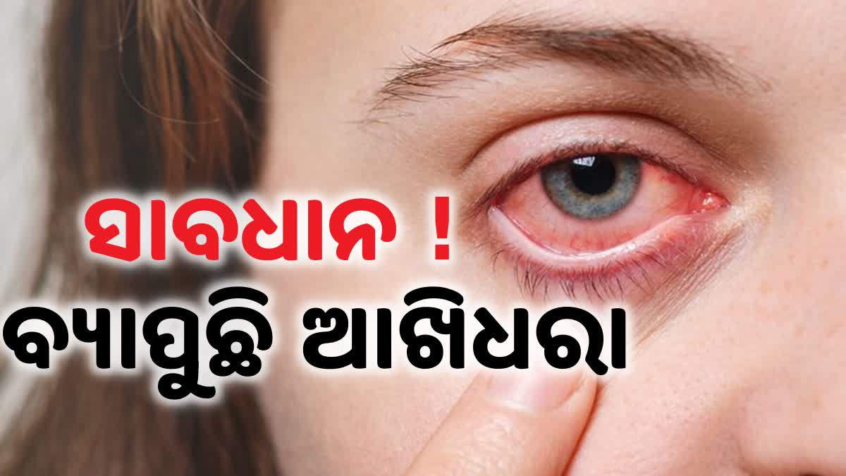 pink eye disease