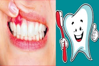 gums-bleeding-problem-bleeding-while-brushing-and-prevention