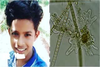boy died by Rare Brain Infection in kerala