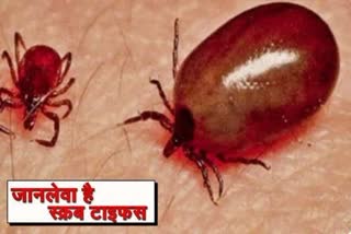 scrub typhus in himachal pradesh