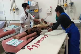 Surat Snake Bite