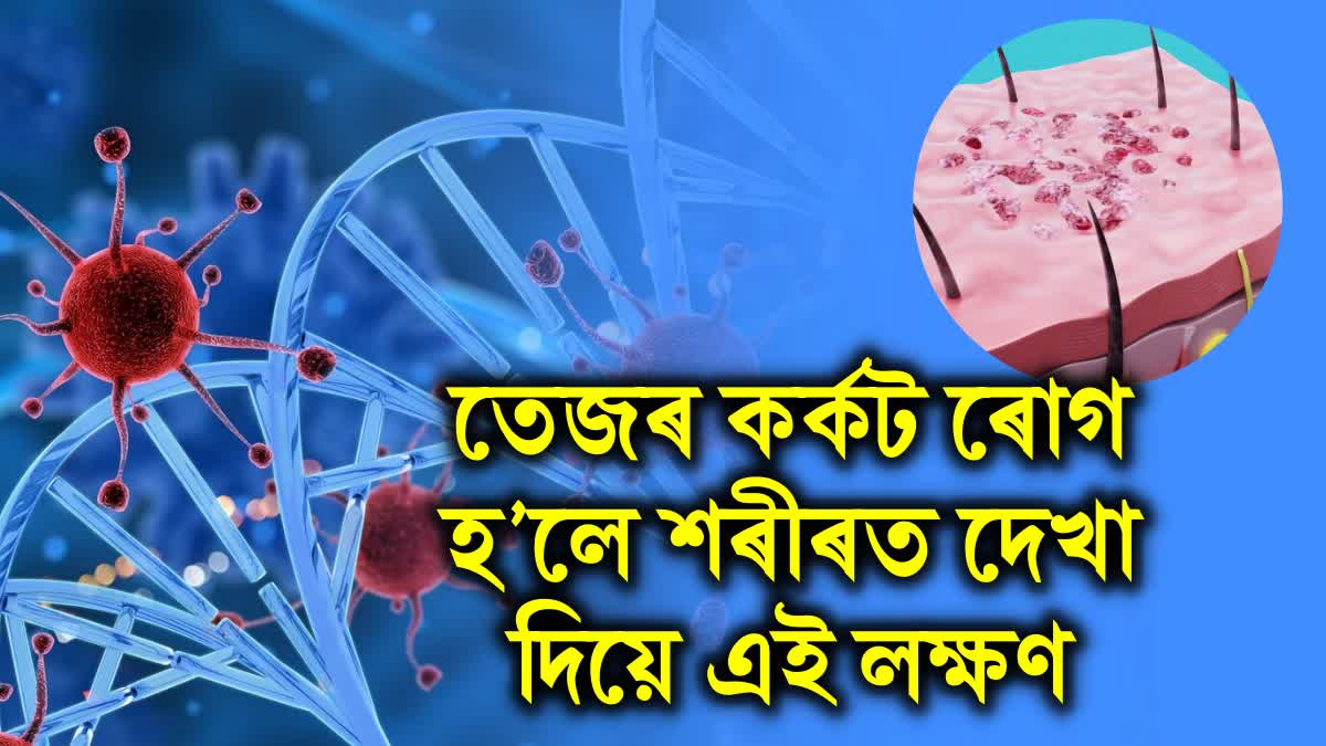 Identify the early symptoms of blood cancer with these easy methods. Get tested immediately