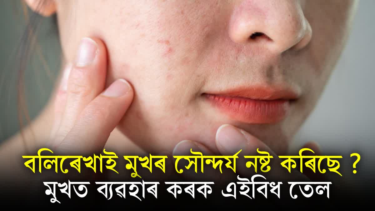 Use this oil to remove Wrinkles on the face, all the marks will go away