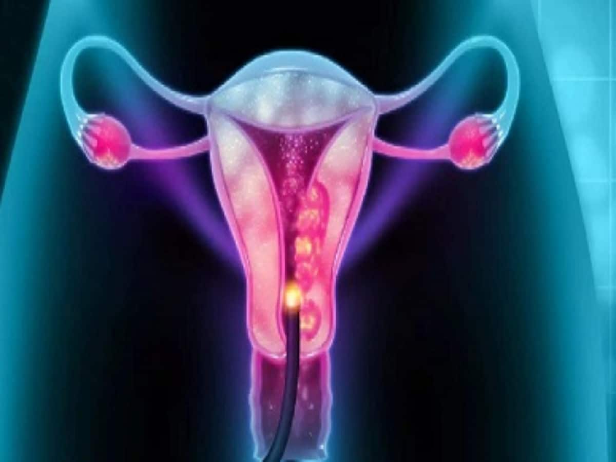 गर्भावस्था के दौरान पता चलती है पीसीओडी की समस्या