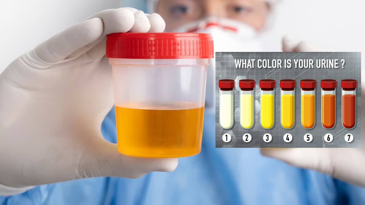 Know how much water your body needs to drink from the color of urine, why drinking too much is also dangerous