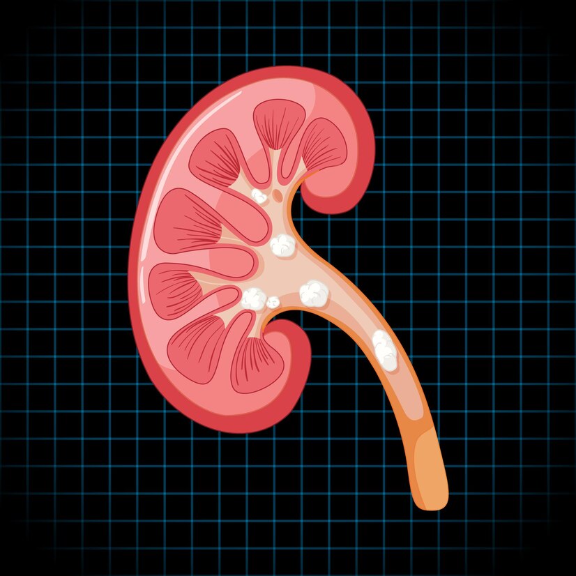 KIDNEY FAILURE SYMPTOMS  TIPS FOR HEALTHY KIDNEYS  SYMPTOMS OF KIDNEY DISEASE  KIDNEY DISEASE