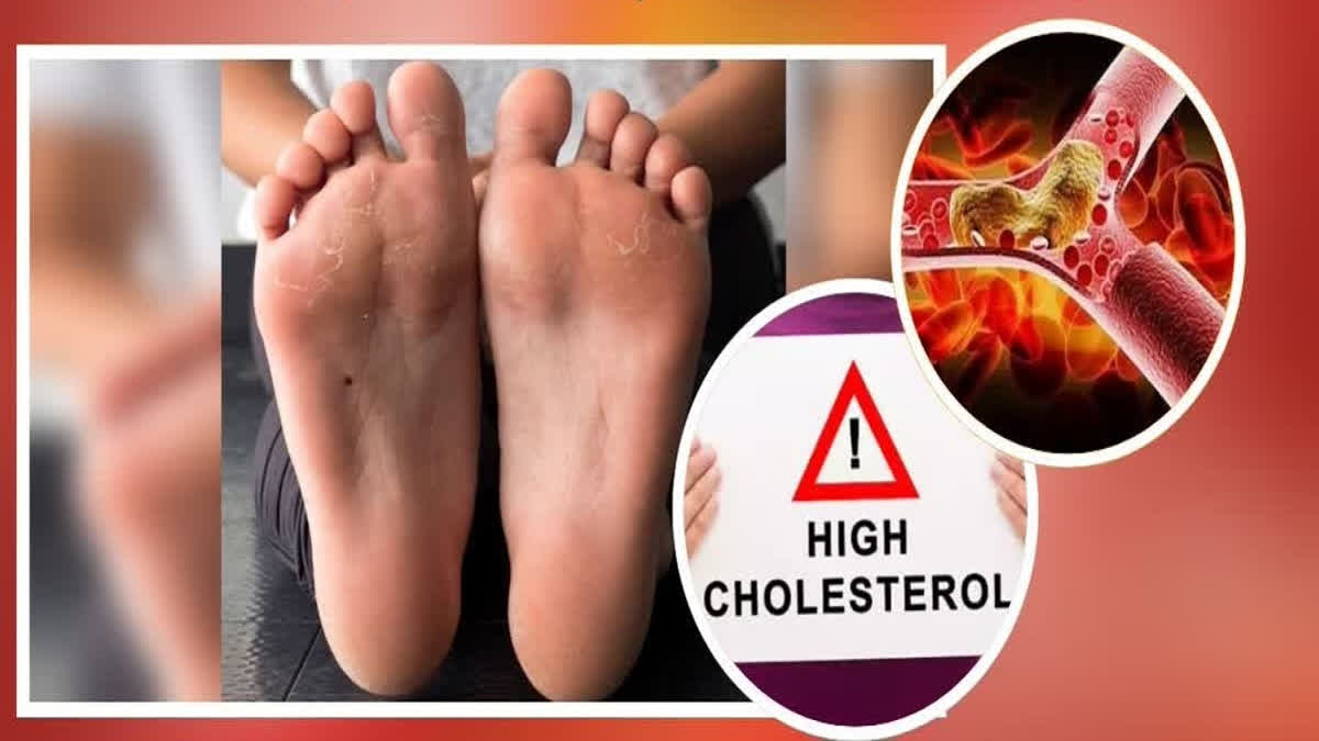 WARNING SIGNS OF HIGH CHOLESTEROL Details here in Kannada