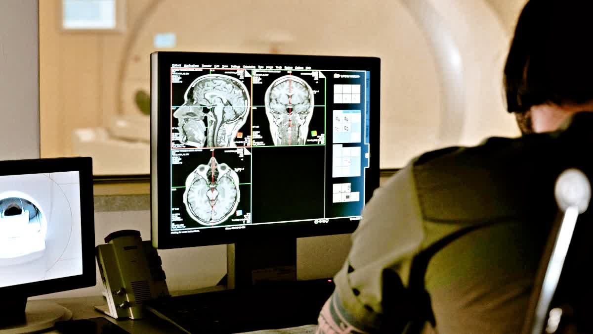 Diagnosing brain tumours early is important for better outcomes