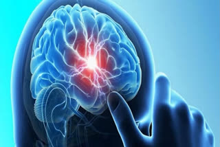 these health symptoms may indicate the potential risk of a brain tumour