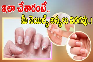 Best Tips For Healthy Nails