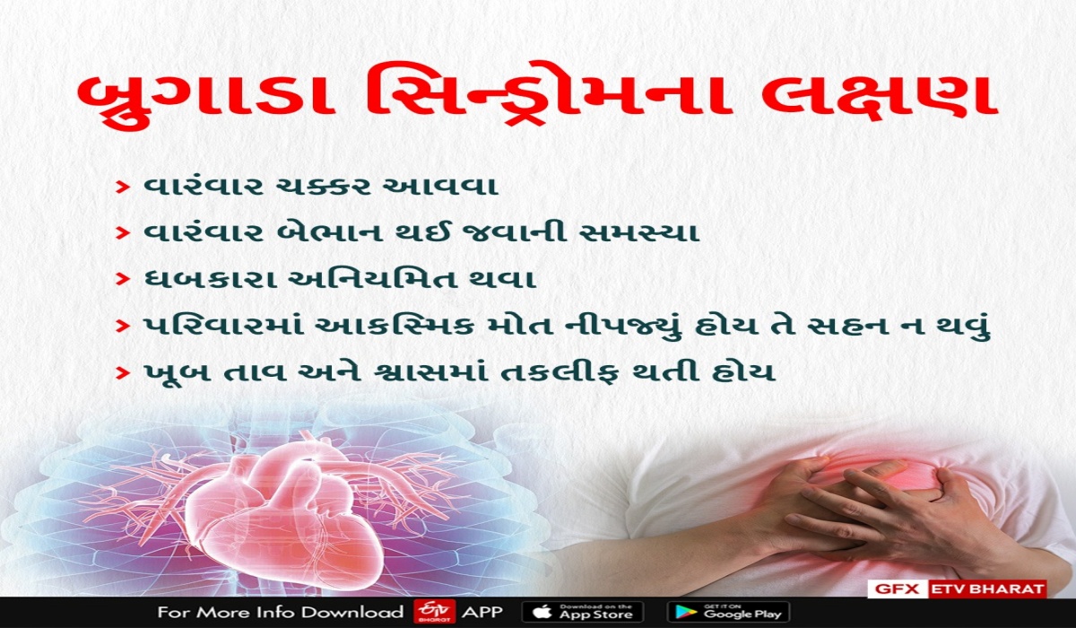 બ્રુગાડા સિન્ડ્રોમ જવાબદાર